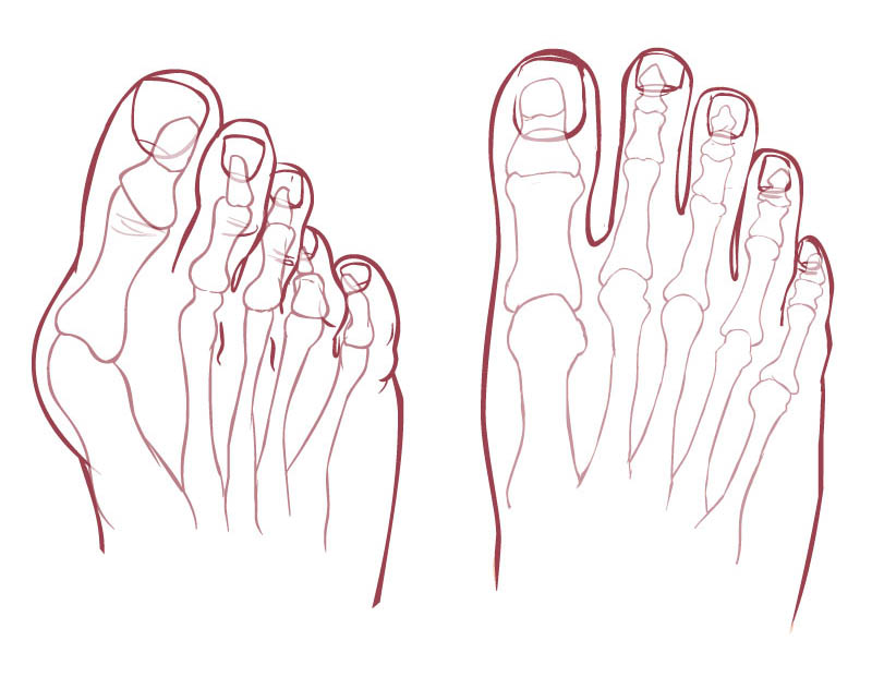 Illustration of a bunion