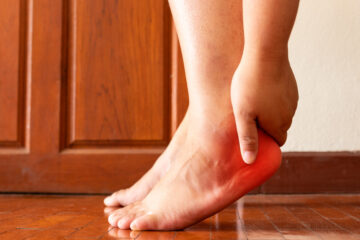 Plantar Fasciitis